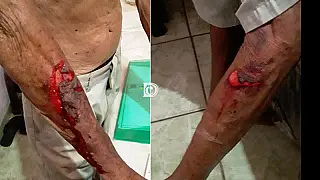 Idoso de 83 anos fica ferido após ser amarrado e amordaçado por mulheres em roubo
