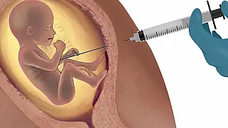 Enquete do dia Rede Jota FM: aborto, você é a favor ou contra?