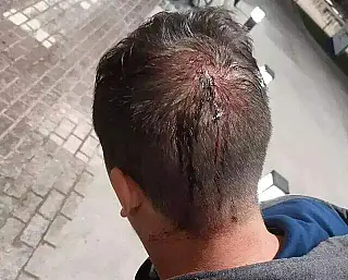 Polícia Prende Sexto Membro da Quadrilha por Roubo a Motoristas de Aplicativo em Campo Grande.