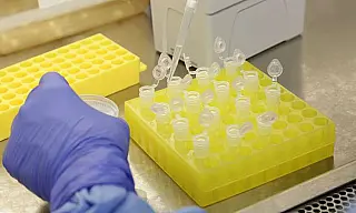 Com mais 94 confirmados, Mato Grosso do Sul passa para 1.356 pacientes com coronavírus