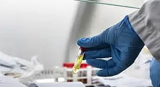 Dia Internacional de Preparação Epidemiológica