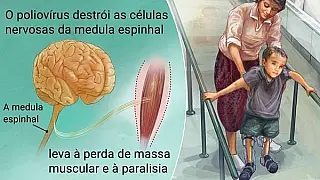 Dia Nacional de Combate à Poliomielite