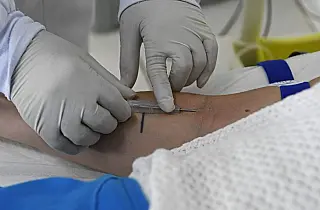 SES reforça vigilância; Mato Grosso do Sul permanece sem hantavirose