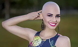 O Dia Mundial do Careca comemora-se em 14 de outubro