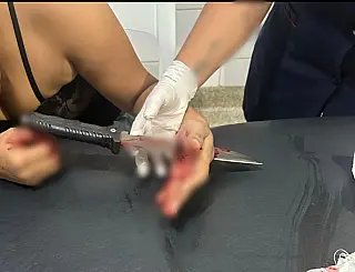 Mulher que teve faca cravada na mão é liberada de hospital em Dourados