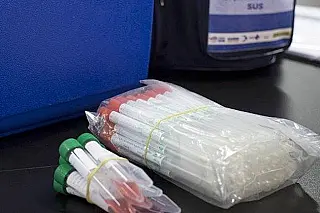 Sidrolândia deve receber novos testes que identificam a doença  ao coronavírus