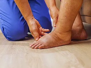 Dia Internacional da Conscientização sobre o Linfedema