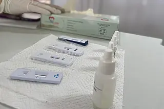 Aids: Casos aumentam no Brasil, mas mortalidade é a menor em uma década