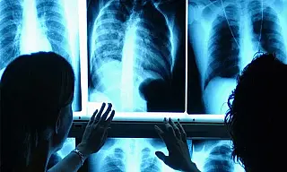 8 de Novembro: Dia do Radiologista celebra profissionais essenciais para a saúde
