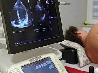 Exames de ultrassom feitos sem contrato em Douradina viram alvo de investigação