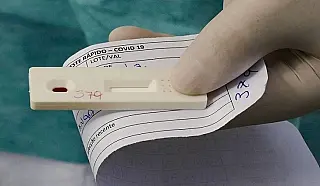 Estado dobra envio de testes rápidos para Dourados e reforça envio aos demais municípios.